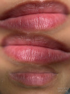 Hydralips