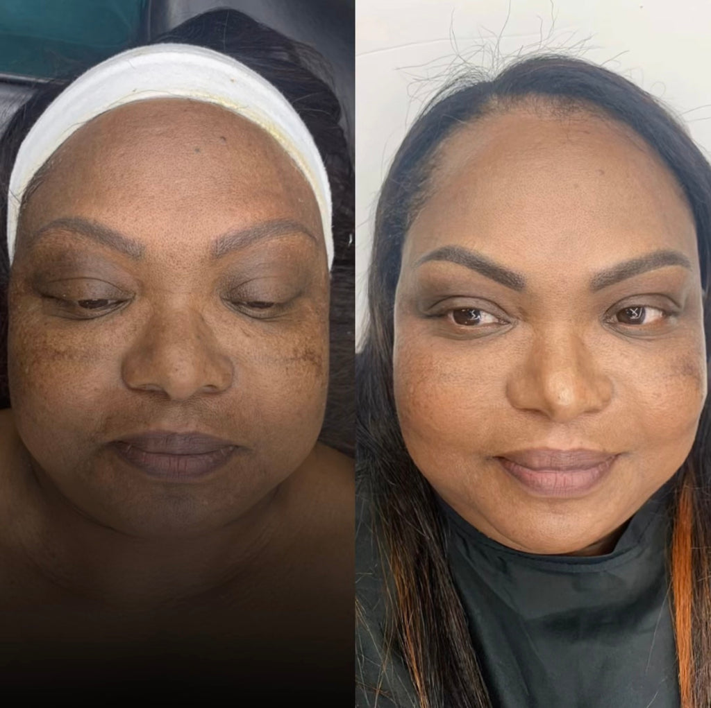 Brow PMU Correction