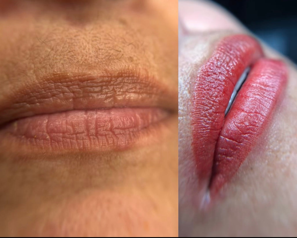 Lip Neutralization