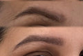 Foligrowth Therapy