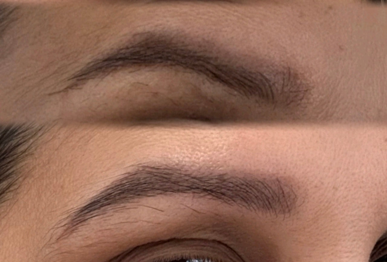 Foligrowth Therapy