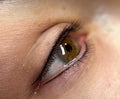 LASH ENHANCEMENT TOP OR BOTTOM